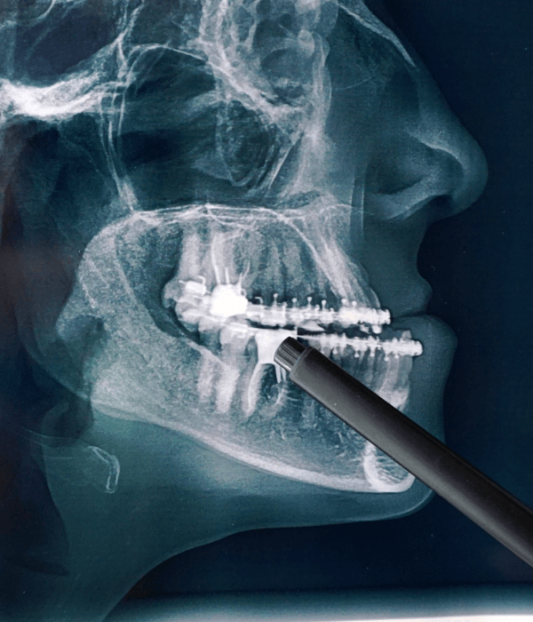 cirugia-maxilofacial-precio.png