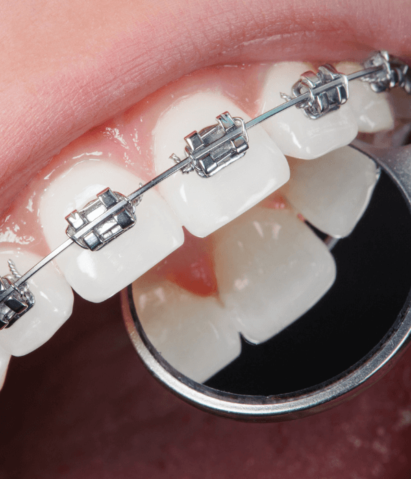 dentista-especialista-en-ortodoncia-invisible.png
