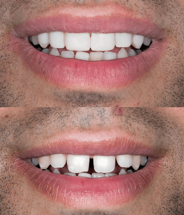 diseno-de-sonrisa-cerca-de-mi-ubicacion.png