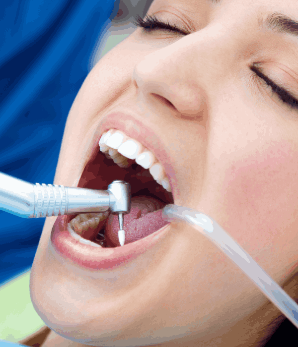 Extracción Dental Sin Dolor