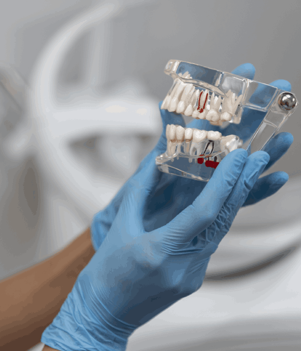 Implantes Dentales Garantizados