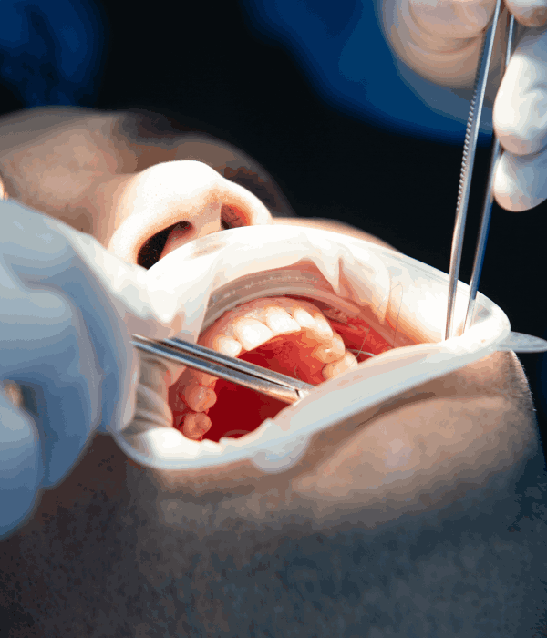 Números De Emergencia Dental