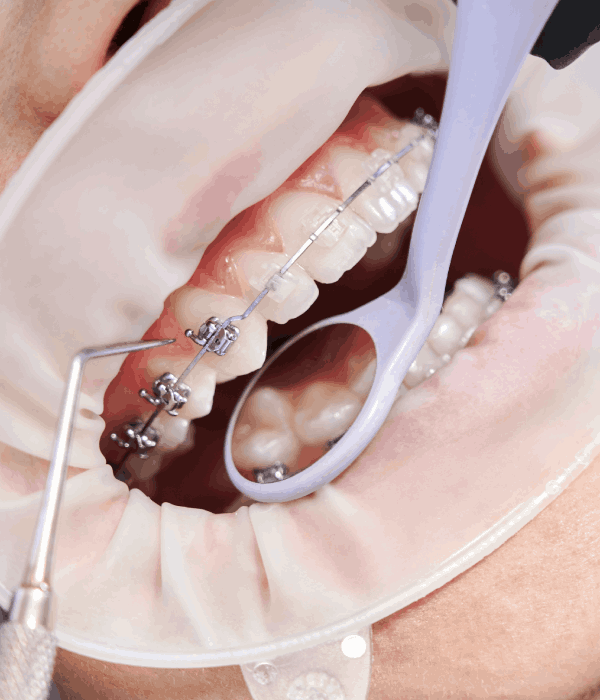 Precio Consulta Dental