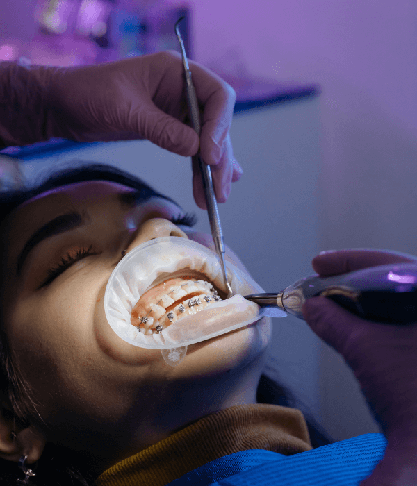 restauracion-dental-con-resina-precio.png