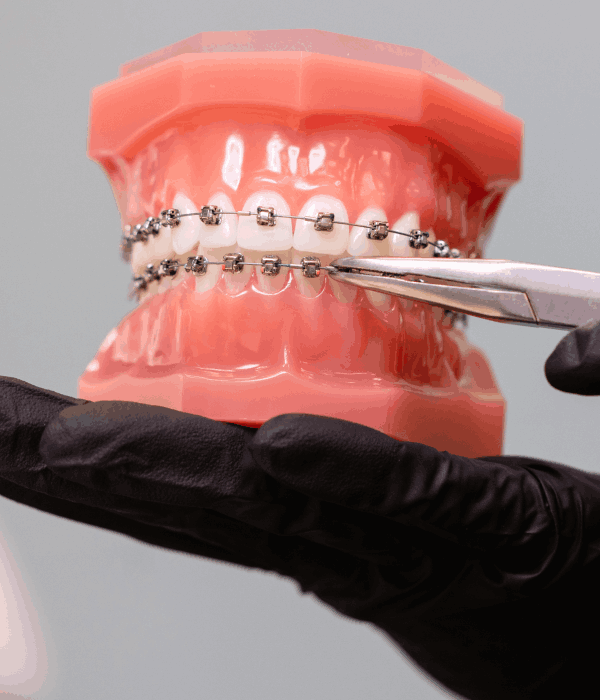 Segunda Opinión Dental