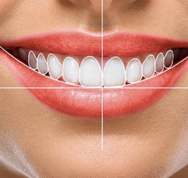 Estética Dental