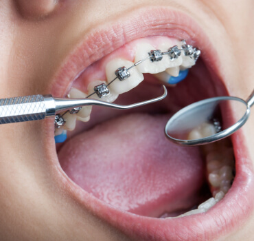 Ortodoncia y Ortopedia Dentomaxilar