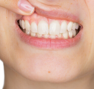 Periodoncia