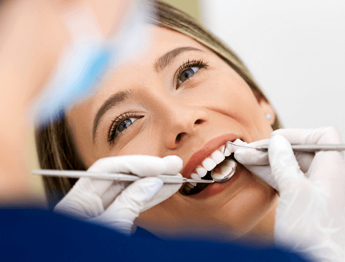 Estética dental 