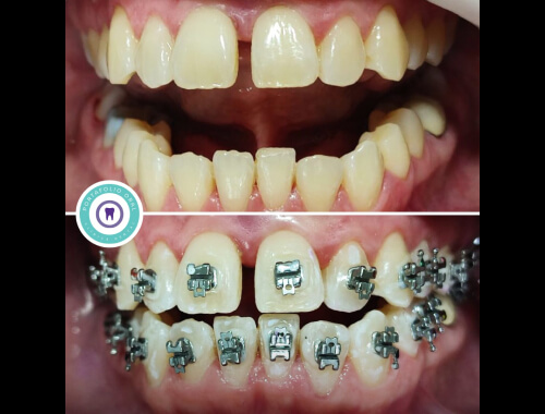 Ortodoncia y Ortopedia Dentomaxilar