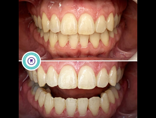 Ortodoncia y Ortopedia Dentomaxilar