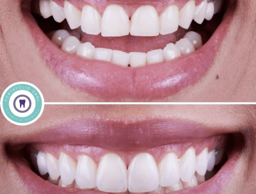 Rehabilitación Oral 